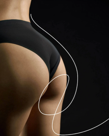 Non-surgical butt-lift in London